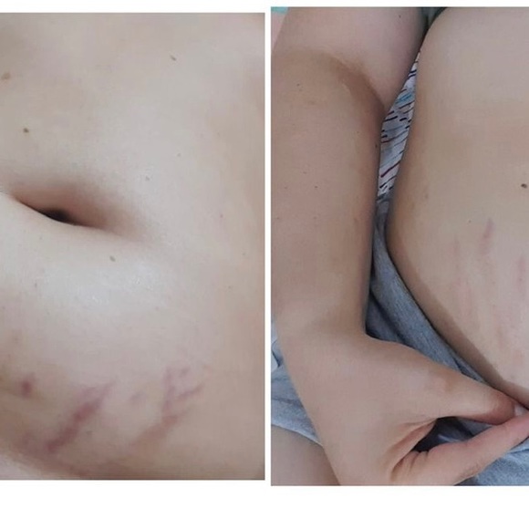 Meet your Posher, MB Distributor, LLC - Picture 17 of 17